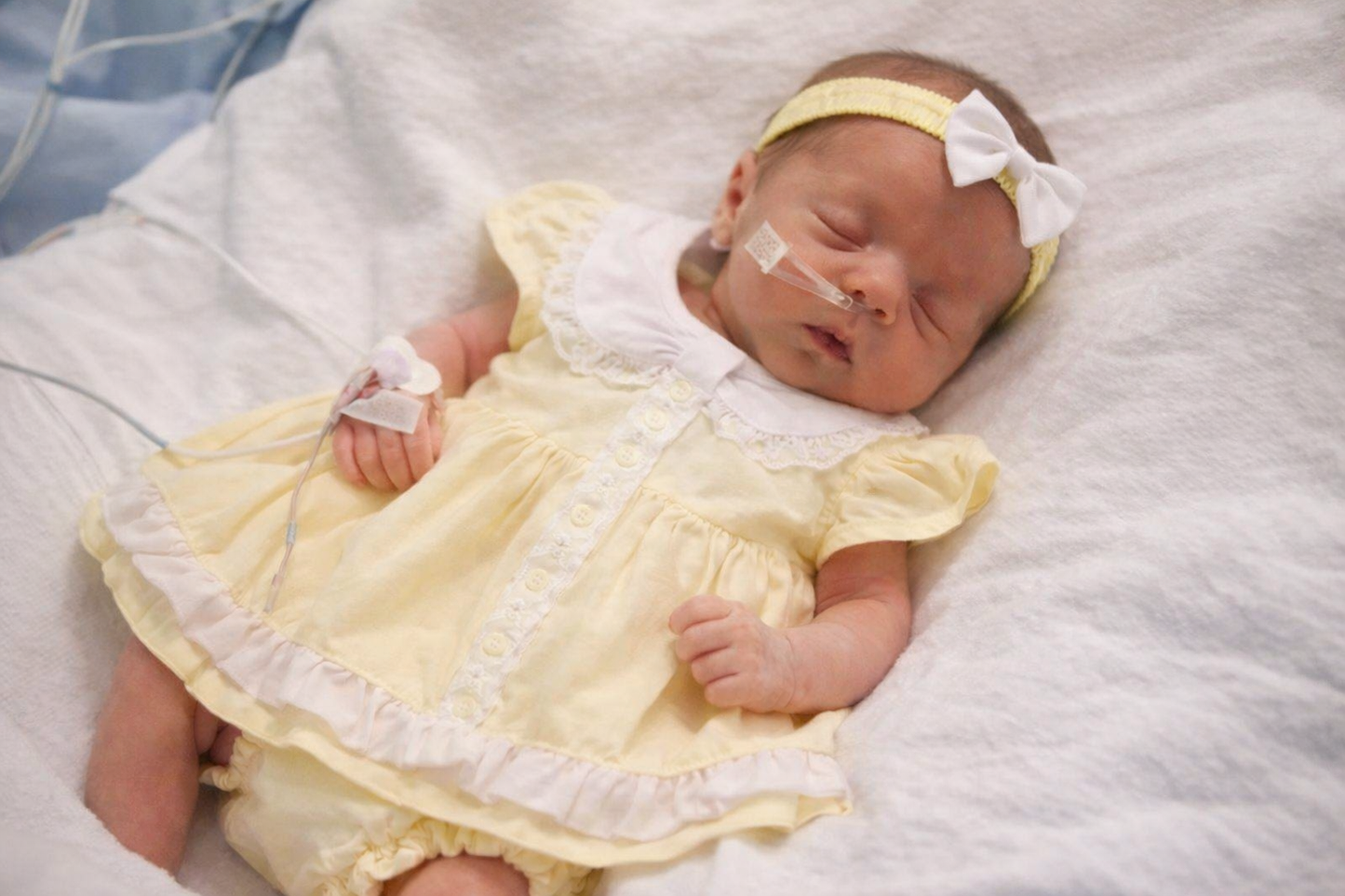 Newborn baby in a yellow dress with medical equipment on a white blanket